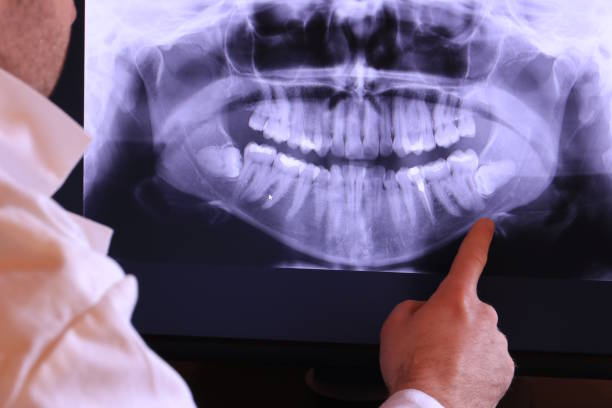 Best Emergency Treatment for Dental Infections or Abscesses in Manana, HI